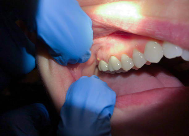 Best Pediatric Emergency Dentist in Wadley, GA