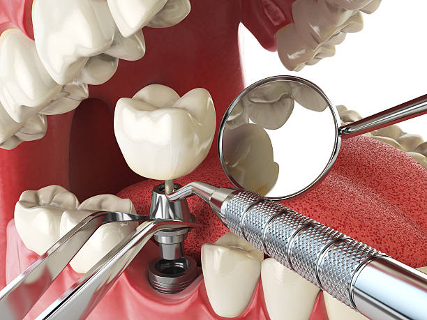 Best Emergency Dental Surgery in Wadley, GA