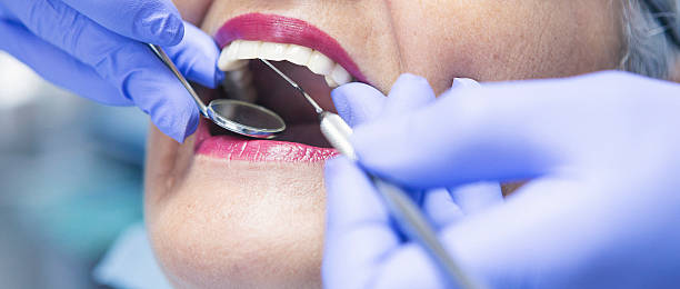 Best Emergency Wisdom Teeth Removal in Wadley, GA